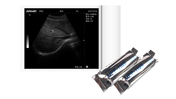 Film noir blanc haute brillance UPP-110S /UPP- 110HG, rouleau de papier thermique à ultrasons 110mm x 18m pour imprimante vidéo Sony