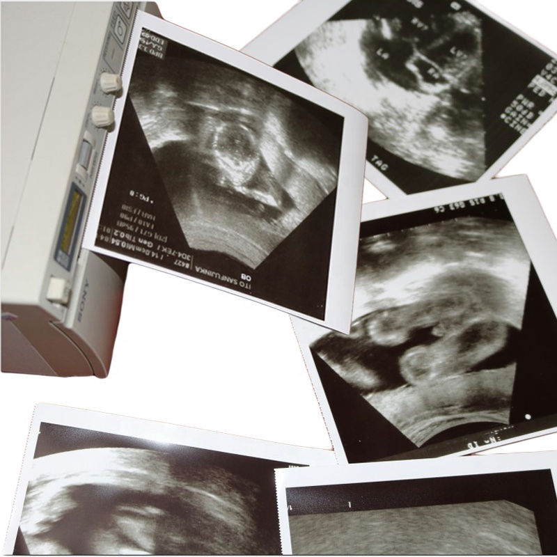 Papier thermique à ultrasons 110S